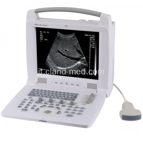 Prezzo portatile della macchina di ultrasuono dell&#39;analizzatore di ultrasuono del computer portatile